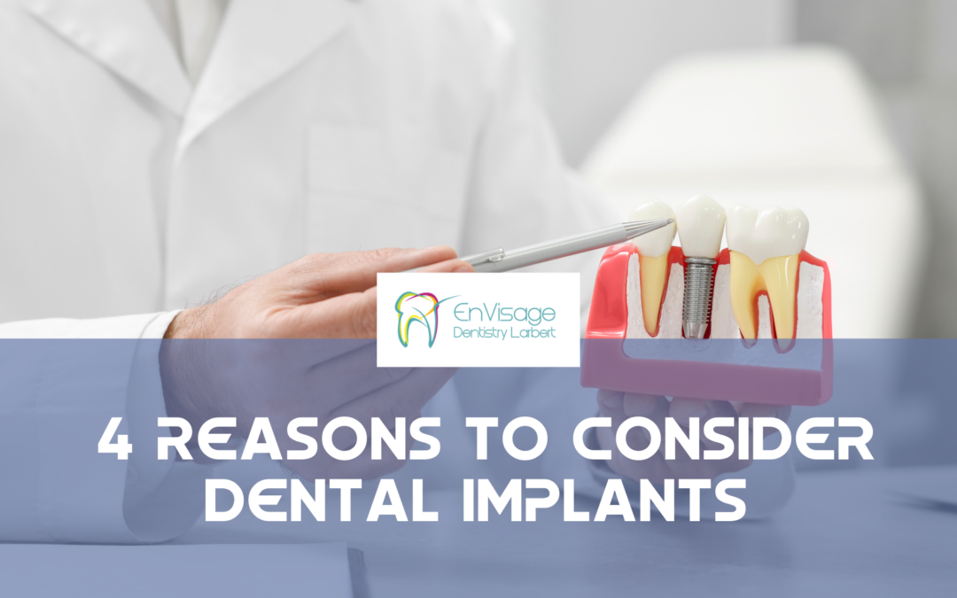 4 Reasons to Consider Dental Implants