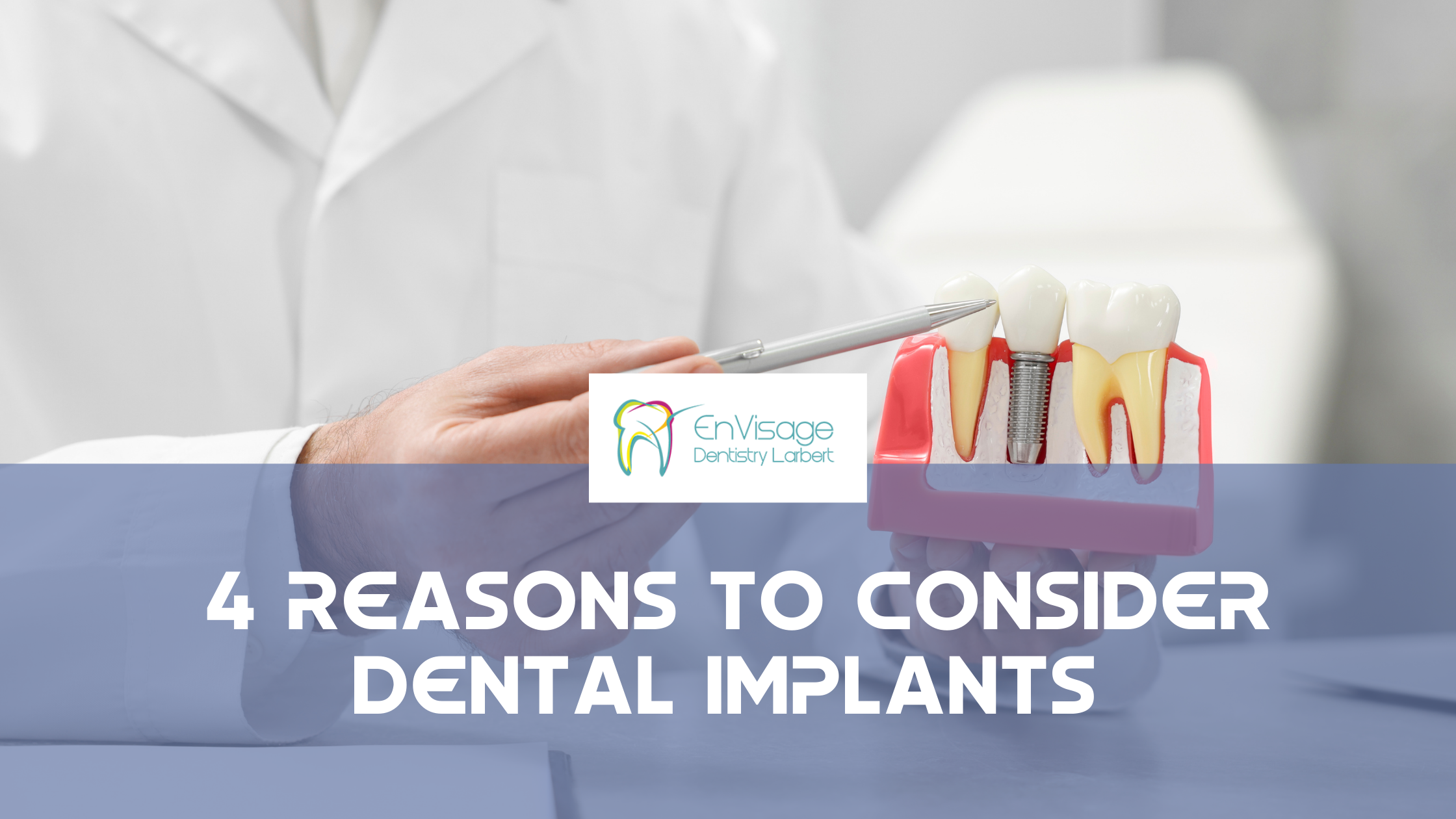 4 Reasons to Consider Dental Implants 